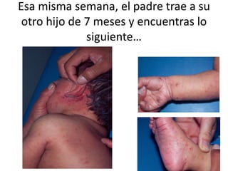 Esa misma semana, el padre trae a su
otro hijo de 7 meses y encuentras lo
siguiente…
 