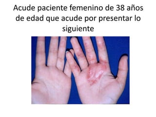 Acude paciente femenino de 38 años
de edad que acude por presentar lo
siguiente
 