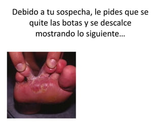 Debido a tu sospecha, le pides que se
quite las botas y se descalce
mostrando lo siguiente…
 
