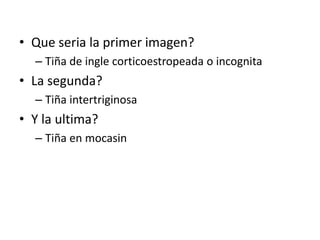 • Que seria la primer imagen?
– Tiña de ingle corticoestropeada o incognita
• La segunda?
– Tiña intertriginosa
• Y la ultima?
– Tiña en mocasin
 