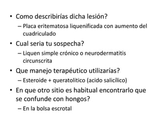 • Como describirías dicha lesión?
– Placa eritematosa liquenificada con aumento del
cuadriculado
• Cual seria tu sospecha?
– Liquen simple crónico o neurodermatitis
circunscrita
• Que manejo terapéutico utilizarías?
– Esteroide + queratolitico (acido salicílico)
• En que otro sitio es habitual encontrarlo que
se confunde con hongos?
– En la bolsa escrotal
 