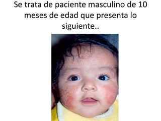 Se trata de paciente masculino de 10
meses de edad que presenta lo
siguiente..
 