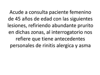 Acude a consulta paciente femenino
de 45 años de edad con las siguientes
lesiones, refiriendo abundante prurito
en dichas zonas, al interrogatorio nos
refiere que tiene antecedentes
personales de rinitis alergica y asma
 