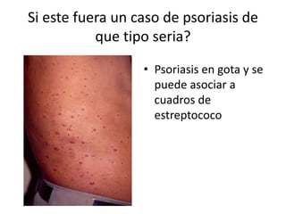 Si este fuera un caso de psoriasis de
que tipo seria?
• Psoriasis en gota y se
puede asociar a
cuadros de
estreptococo
 