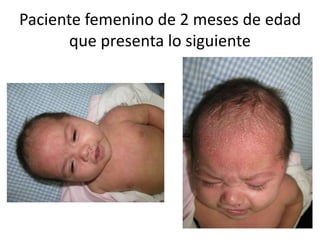 Paciente femenino de 2 meses de edad
que presenta lo siguiente
 