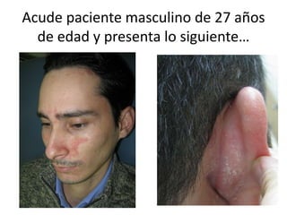 Acude paciente masculino de 27 años
de edad y presenta lo siguiente…
 