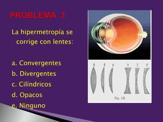La hipermetropía se
 corrige con lentes:


a. Convergentes
b. Divergentes
c. Cilíndricos
d. Opacos
e. Ninguno
 