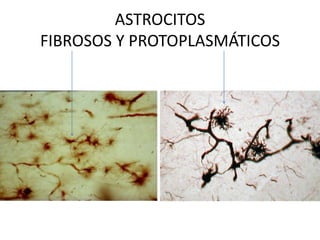 ASTROCITOS
FIBROSOS Y PROTOPLASMÁTICOS

 