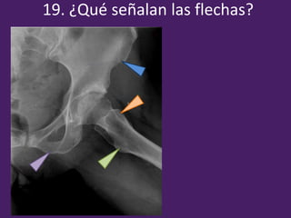 19. ¿Qué señalan las flechas?
 