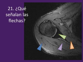 21. ¿Qué
señalan las
flechas?
 