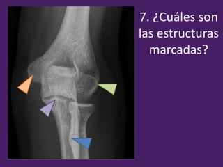 7. ¿Cuáles son
las estructuras
marcadas?
 