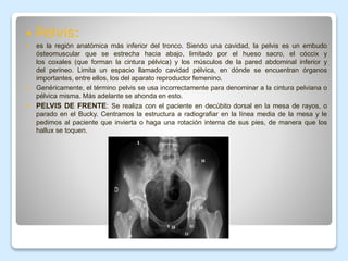  Pelvis:
 es la región anatómica más inferior del tronco. Siendo una cavidad, la pelvis es un embudo
ósteomuscular que se estrecha hacia abajo, limitado por el hueso sacro, el cóccix y
los coxales (que forman la cintura pélvica) y los músculos de la pared abdominal inferior y
del perineo. Limita un espacio llamado cavidad pélvica, en dónde se encuentran órganos
importantes, entre ellos, los del aparato reproductor femenino.
 Genéricamente, el término pelvis se usa incorrectamente para denominar a la cintura pelviana o
pélvica misma. Más adelante se ahonda en esto.
 PELVIS DE FRENTE: Se realiza con el paciente en decúbito dorsal en la mesa de rayos, o
parado en el Bucky. Centramos la estructura a radiografiar en la línea media de la mesa y le
pedimos al paciente que invierta o haga una rotación interna de sus pies, de manera que los
hallux se toquen.
 