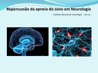 Culebras Revista de neurologia. 1:67-70.
Repercussão da apneia do sono em Neurologia
 