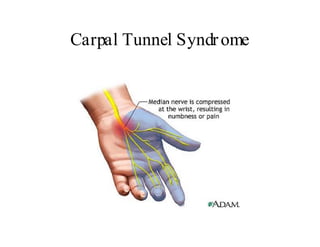 Repetitive Strain Injury Low Res