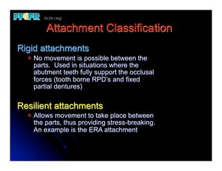Attachment Classification
Rigid attachments
  v   No movement is possible between the
       parts. Used in situations where the
       abutment teeth fully support the occlusal
       forces (tooth borne RPD’s and fixed
       partial dentures)


Resilient attachments
  v   Allows movement to take place between
       the parts, thus providing stress-breaking.
       An example is the ERA attachment
 