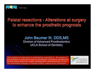 Palatal resections - Alterations at surgery
  to enhance the prosthetic prognosis

                   John Beumer III, DDS,MS
                  Division of Advanced Prosthodontics
                        UCLA School of Dentistry



This program of instruction is protected by copyright ©. No portion of
this program of instruction may be reproduced, recorded or transferred
by any means electronic, digital, photographic, mechanical etc., or by
any information storage or retrieval system, without prior permission.
 