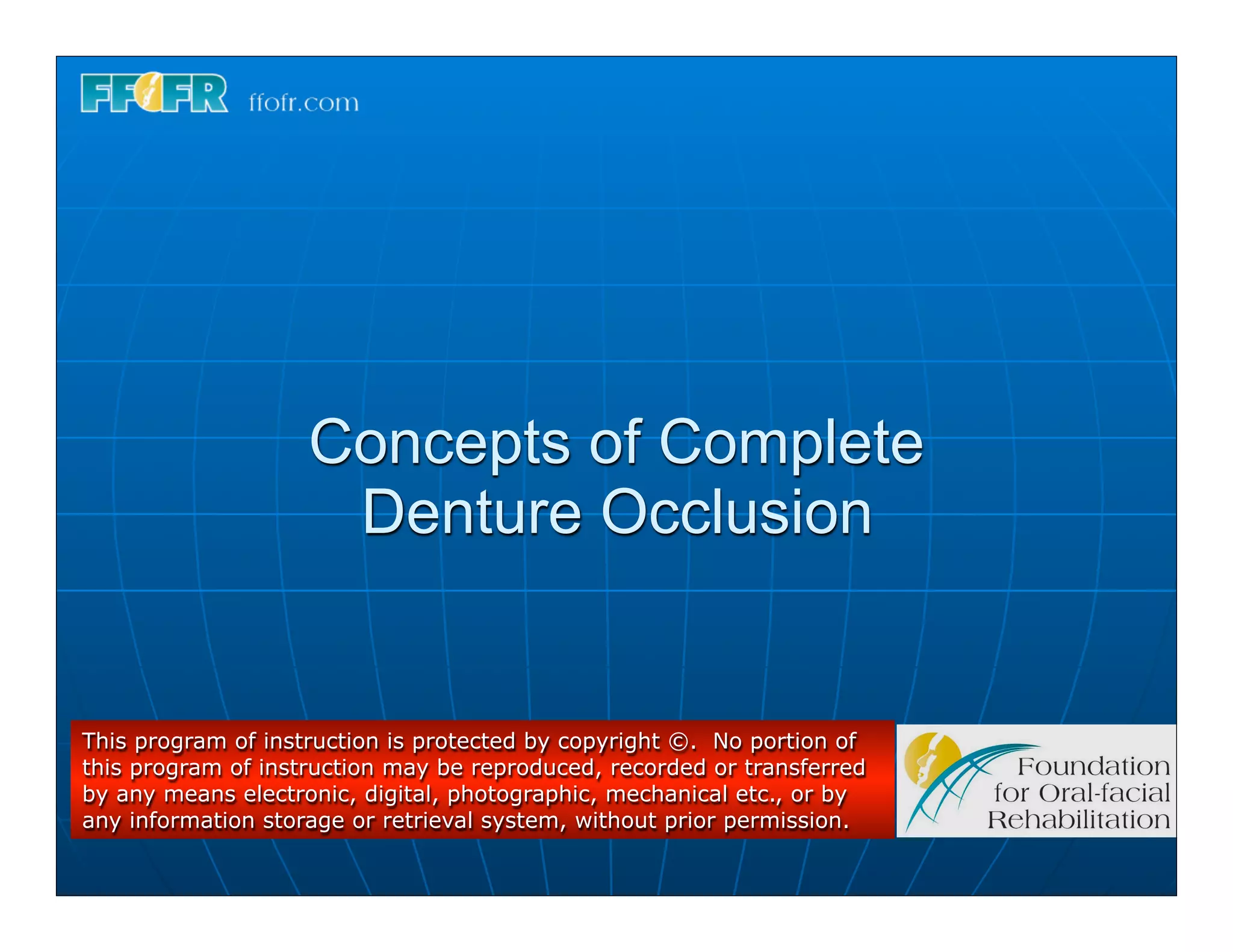 Concepts of Complete
                     Denture Occlusion


This program of instruction is protected by copyright ©. No portion of
this program of instruction may be reproduced, recorded or transferred
by any means electronic, digital, photographic, mechanical etc., or by
any information storage or retrieval system, without prior permission.
 