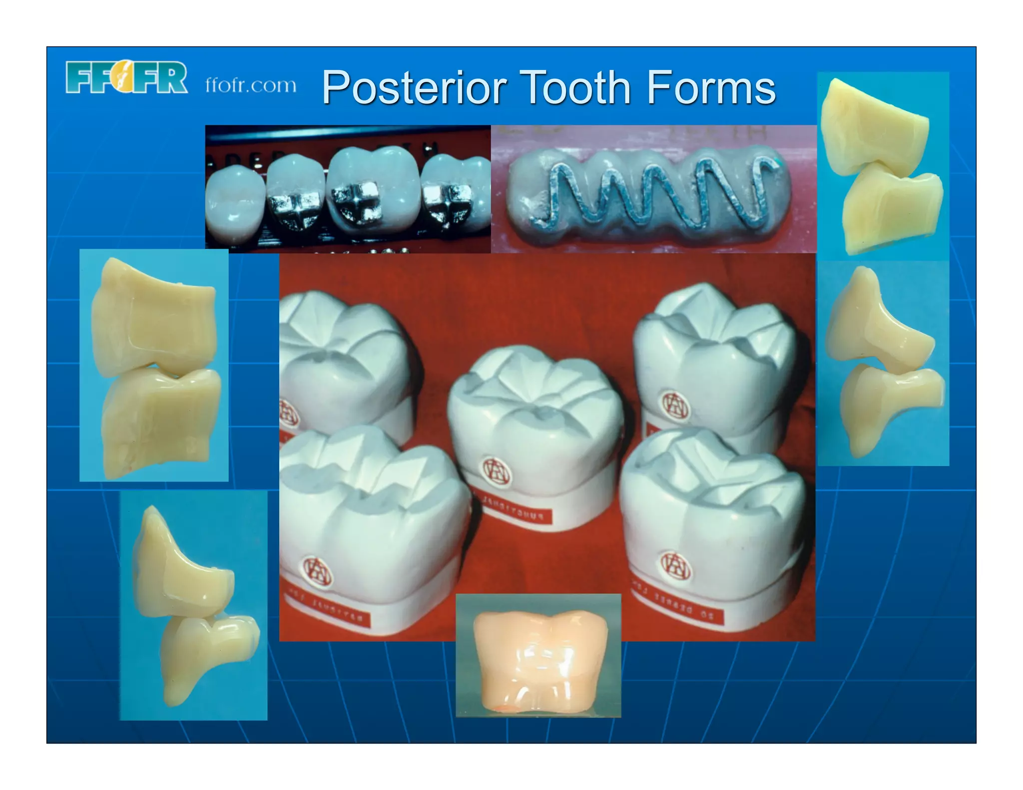 Posterior Tooth Forms
 