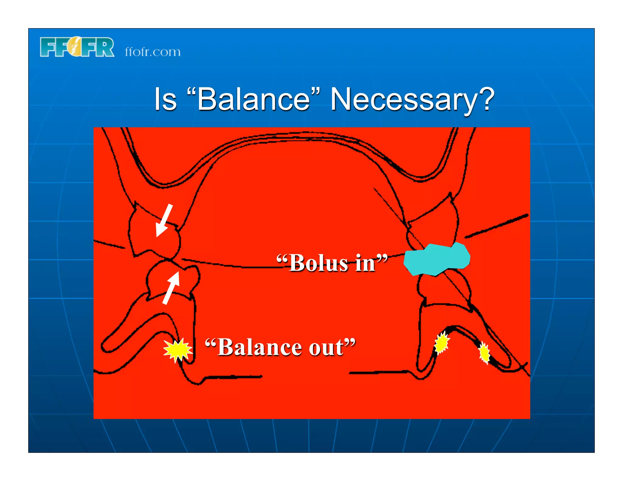 Is “Balance” Necessary?




         “Bolus in”


   “Balance out”
 