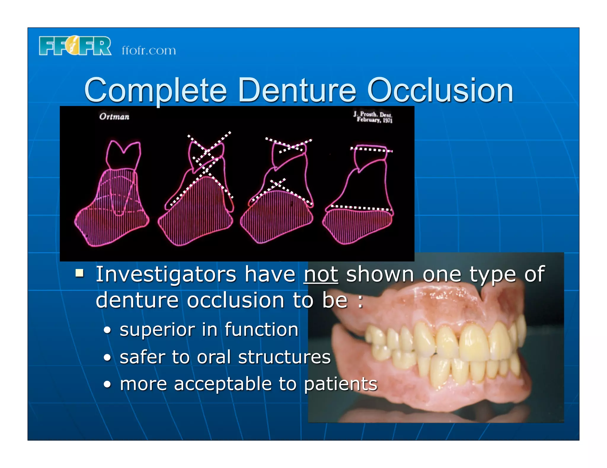 Complete Denture Occlusion




n   Investigators have not shown one type of
     denture occlusion to be :
     • superior in function
     • safer to oral structures
     • more acceptable to patients
 
