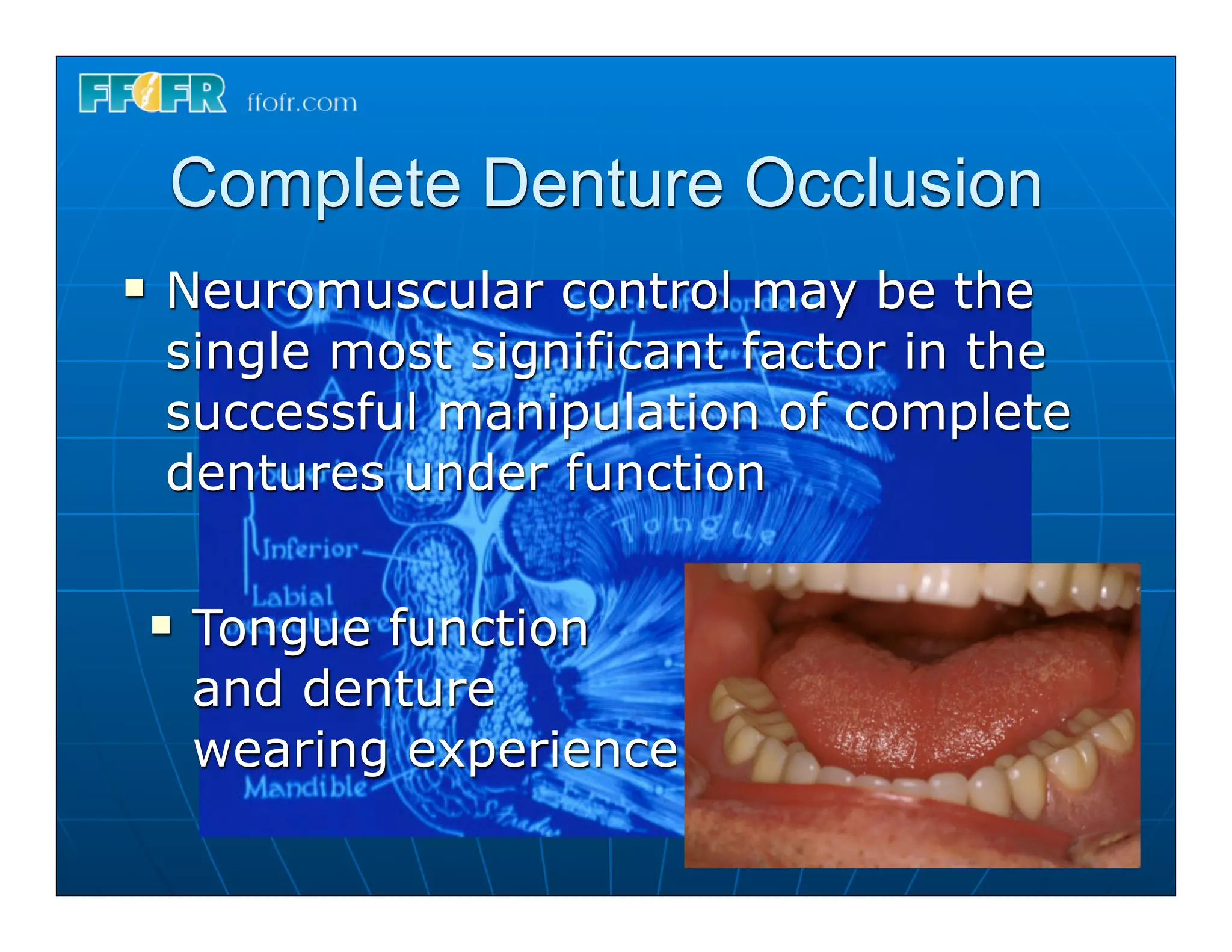 Complete Denture Occlusion
n    Neuromuscular control may be the
      single most significant factor in the
      successful manipulation of complete
      dentures under function

     n   Tongue function
          and denture
          wearing experience
 