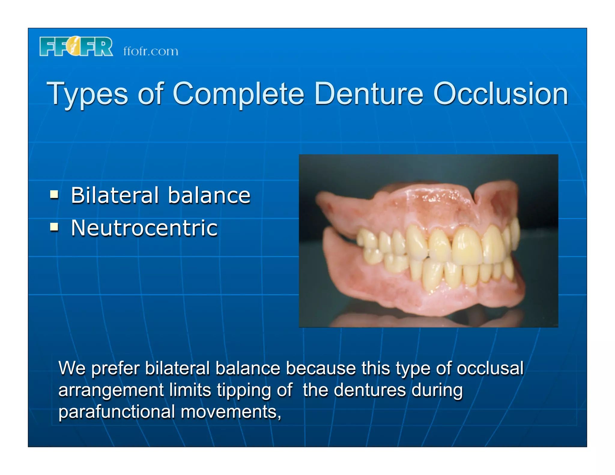 Types of Complete Denture Occlusion


n   Bilateral balance
n   Neutrocentric




 We prefer bilateral balance because this type of occlusal
 arrangement limits tipping of the dentures during
 parafunctional movements,
 