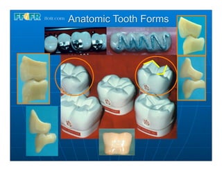 Anatomic Tooth Forms
 