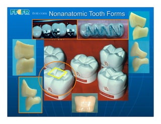 Nonanatomic Tooth Forms
 