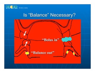 Is “Balance” Necessary?




         “Bolus in”


   “Balance out”
 