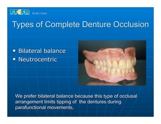 Types of Complete Denture Occlusion


n   Bilateral balance
n   Neutrocentric




 We prefer bilateral balance because this type of occlusal
 arrangement limits tipping of the dentures during
 parafunctional movements,
 