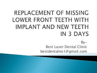 ByBest Laser Dental Clinic
bestdentalno1@gmail.com

 