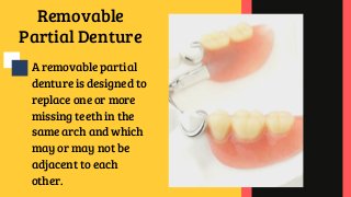 Removable
Partial Denture
A removable partial
denture is designed to
replace one or more
missing teeth in the
same arch and which
may or may not be
adjacent to each
other.
 