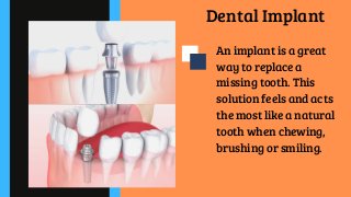 Dental Implant
An implant is a great
way to replace a
missing tooth. This
solution feels and acts
the most like a natural
tooth when chewing,
brushing or smiling.
 