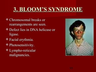 93
3. BLOOM’S SYNDROME3. BLOOM’S SYNDROME
 Chromosomal breaks orChromosomal breaks or
rearrangements are seen.rearrangements are seen.
 Defect lies in DNA helicase orDefect lies in DNA helicase or
ligase.ligase.
 Facial erythmia.Facial erythmia.
 Photosensitivity.Photosensitivity.
 Lympho-reticularLympho-reticular
malignancies.malignancies.
 