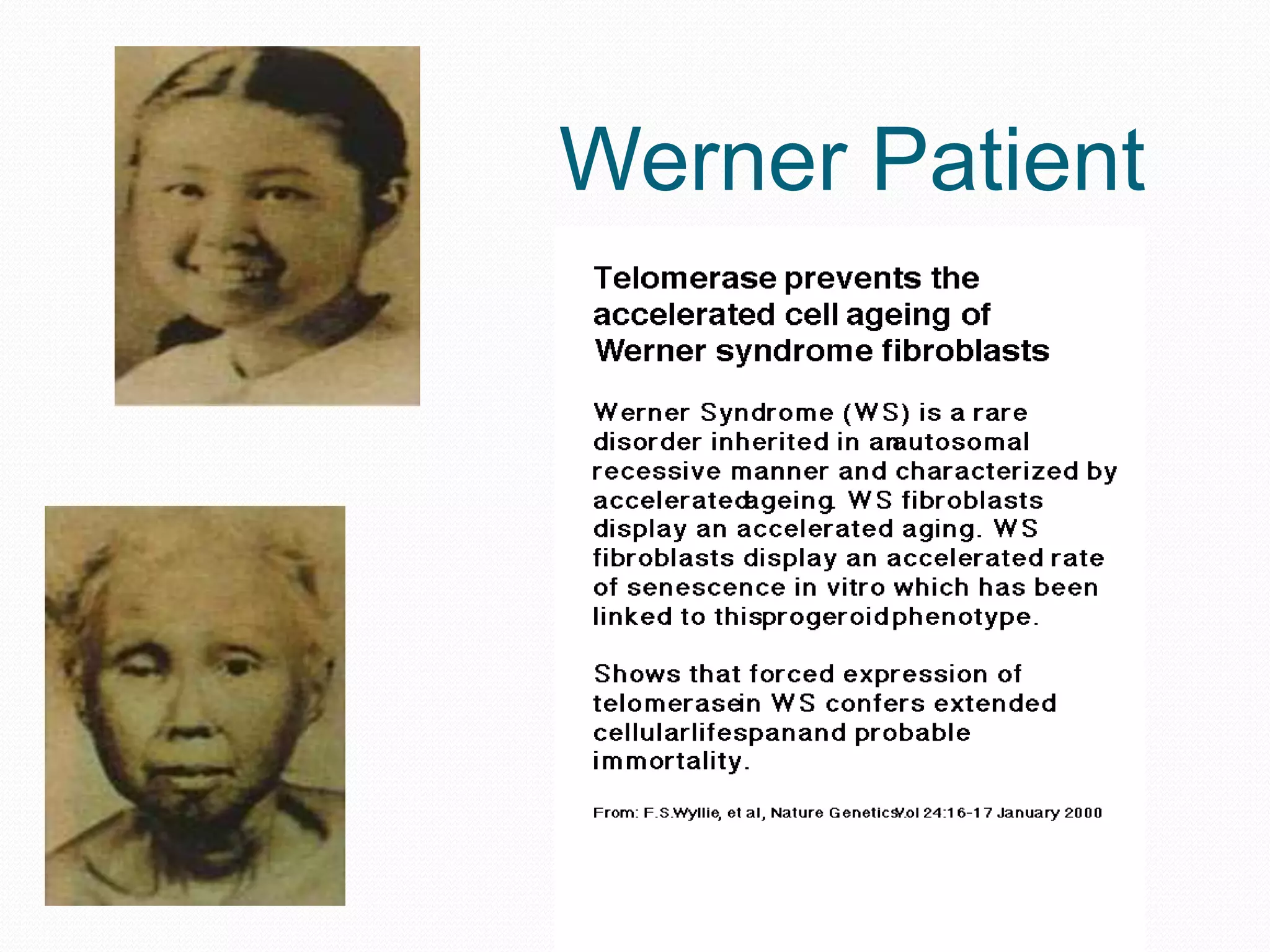 Werner Patient

 