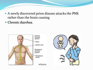  A newly discovered prion disease attacks the PNS
rather than the brain causing
 Chronic diarrhea.
 