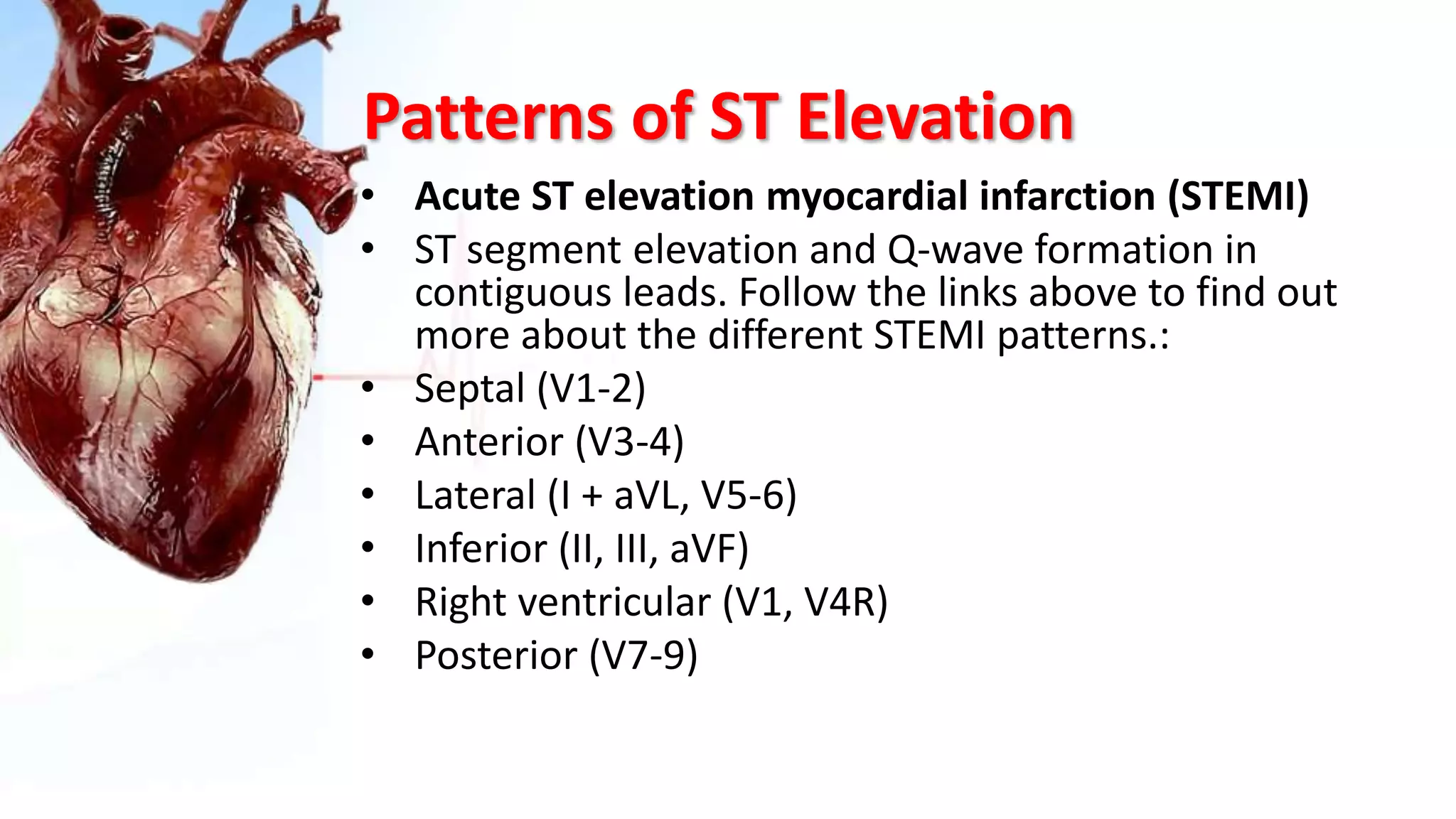 Patterns of ST Elevation
• Acute ST elevation myocardial infarction (STEMI)
• ST segment elevation and Q-wave formation in
contiguous leads. Follow the links above to find out
more about the different STEMI patterns.:
• Septal (V1-2)
• Anterior (V3-4)
• Lateral (I + aVL, V5-6)
• Inferior (II, III, aVF)
• Right ventricular (V1, V4R)
• Posterior (V7-9)
 