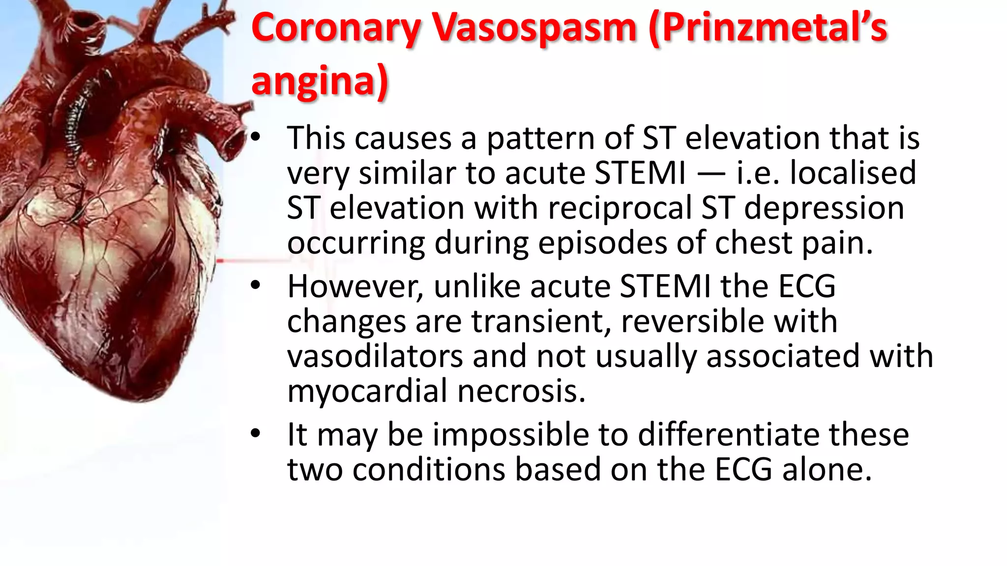 Coronary Vasospasm (Prinzmetal’s
angina)
• This causes a pattern of ST elevation that is
very similar to acute STEMI — i.e. localised
ST elevation with reciprocal ST depression
occurring during episodes of chest pain.
• However, unlike acute STEMI the ECG
changes are transient, reversible with
vasodilators and not usually associated with
myocardial necrosis.
• It may be impossible to differentiate these
two conditions based on the ECG alone.
 