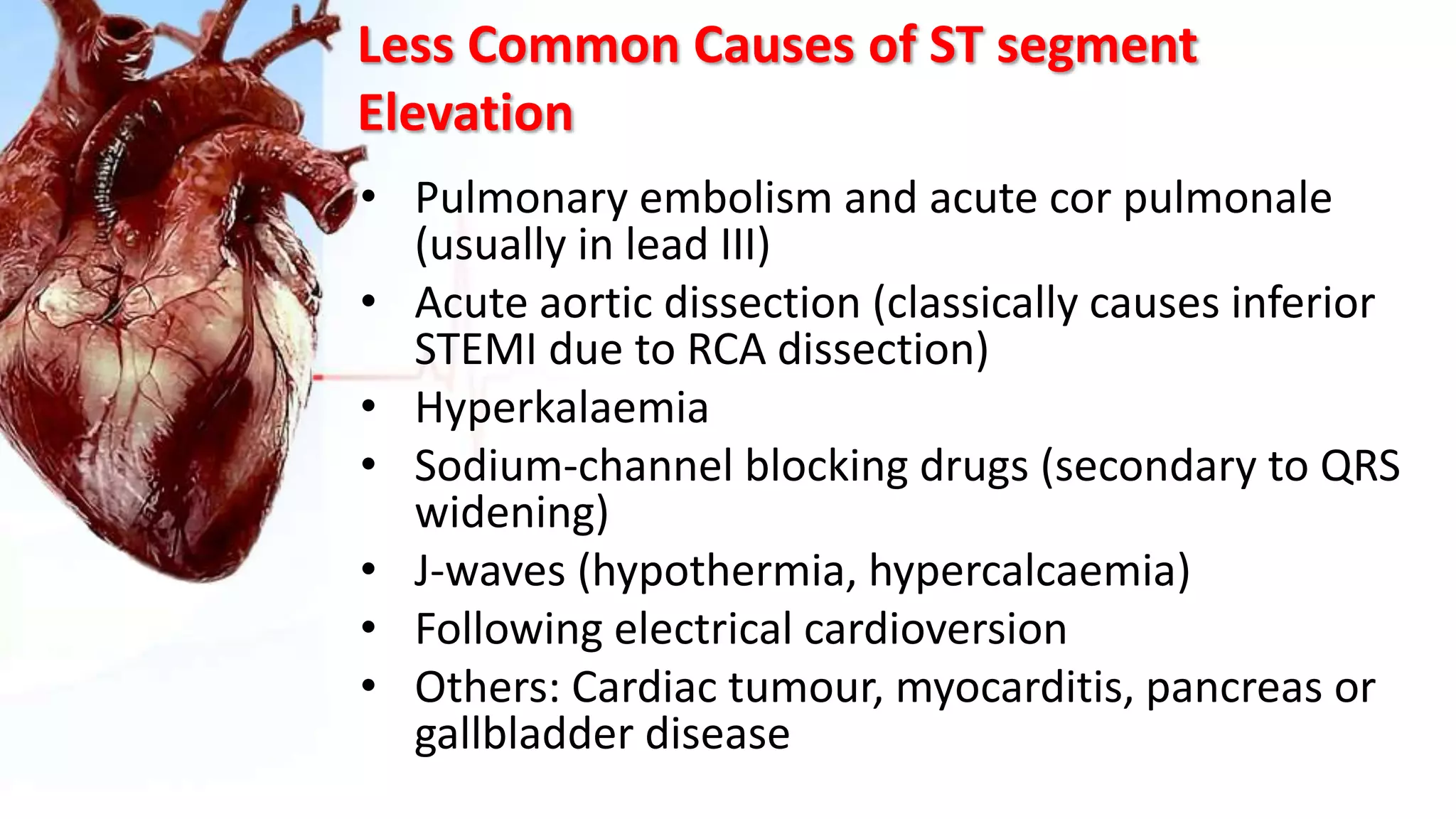 Less Common Causes of ST segment
Elevation
• Pulmonary embolism and acute cor pulmonale
(usually in lead III)
• Acute aortic dissection (classically causes inferior
STEMI due to RCA dissection)
• Hyperkalaemia
• Sodium-channel blocking drugs (secondary to QRS
widening)
• J-waves (hypothermia, hypercalcaemia)
• Following electrical cardioversion
• Others: Cardiac tumour, myocarditis, pancreas or
gallbladder disease
 