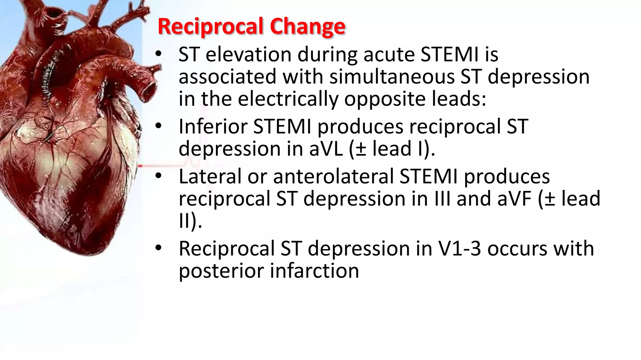 Reciprocal Change
• ST elevation during acute STEMI is
associated with simultaneous ST depression
in the electrically opposite leads:
• Inferior STEMI produces reciprocal ST
depression in aVL (± lead I).
• Lateral or anterolateral STEMI produces
reciprocal ST depression in III and aVF (± lead
II).
• Reciprocal ST depression in V1-3 occurs with
posterior infarction
 