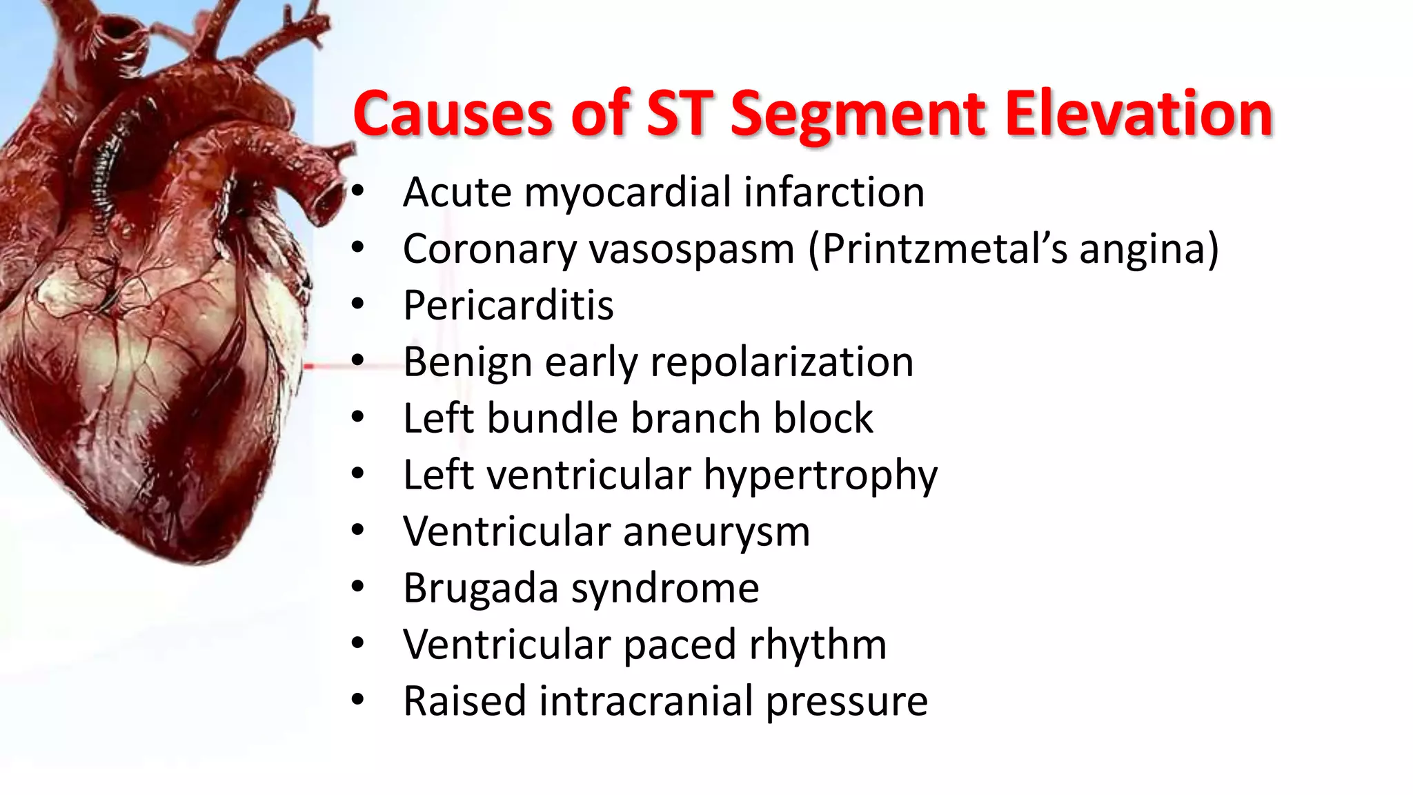 Causes of ST Segment Elevation
• Acute myocardial infarction
• Coronary vasospasm (Printzmetal’s angina)
• Pericarditis
• Benign early repolarization
• Left bundle branch block
• Left ventricular hypertrophy
• Ventricular aneurysm
• Brugada syndrome
• Ventricular paced rhythm
• Raised intracranial pressure
 