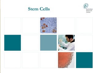          
     
Stem Cells
 