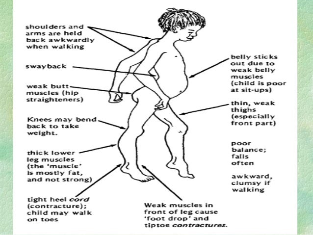 Genetic Disorders