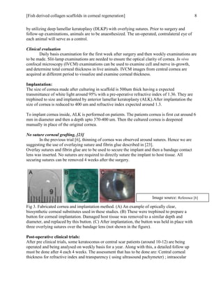 [Fish derived collagen scaffolds in corneal regeneration] 8
by utilizing deep lamellar keratoplasy (DLKP) with overlying sutures. Prior to surgery and
follow-up examinations, animals are to be anaesthesized. The un-operated, contralateral eye of
each animal will serve as a control.
Clinical evaluation
Daily basis examination for the first week after surgery and then weekly examinations are
to be made. Slit-lamp examinations are needed to ensure the optical clarity of cornea. In vivo
confocal microscopy (IVCM) examinations can be used to examine cell and nerve in-growth,
and determine total corneal thickness in live animals. IVCM images from central cornea are
acquired at different period to visualize and examine corneal thickness.
Implantation:
The size of cornea made after culturing in scaffold is 500um thick having a expected
transmittance of white light around 95% with a pre-operative refractive index of 1.36. They are
trephined to size and implanted by anterior lamellar keratoplasty (ALK).After implantation the
size of cornea is reduced to 400 um and refractive index expected around 1.3.
To implant cornea inside, ALK is performed on patients. The patients cornea is first cut around 6
mm in diameter and then a depth upto 370-400 um. Then the cultured cornea is deepened
manually in place of the original cornea.
No suture corneal grafting, [23]
In the previous trial [6], thinning of cornea was observed around sutures. Hence we are
suggesting the use of overlaying suture and fibrin glue described in [23].
Overlay sutures and fibrin glue are to be used to secure the implant and then a bandage contact
lens was inserted. No sutures are required to directly suture the implant to host tissue. All
securing sutures can be removed 4 weeks after the surgery.
Fig 3. Fabricated cornea and implantation method. (A) An example of optically clear,
biosynthetic corneal substitutes used in these studies. (B) These were trephined to prepare a
button for corneal implantation. Damaged host tissue was removed to a similar depth and
diameter, and replaced by this button. (C) After implantation, the button was held in place with
three overlying sutures over the bandage lens (not shown in the figure).
Post-operative clinical trials:
After pre clinical trials, some keratoconus or central scar patients (around 10-12) are being
operated and being analysed on weekly basis for a year. Along with this, a detailed follow up
must be done after 4 each 4 weeks. The assessment that has to be done are: Central corneal
thickness for refractive index and transparency ( using ultrasound pachymeter) ; intraocular
Image source: Reference [6]
 