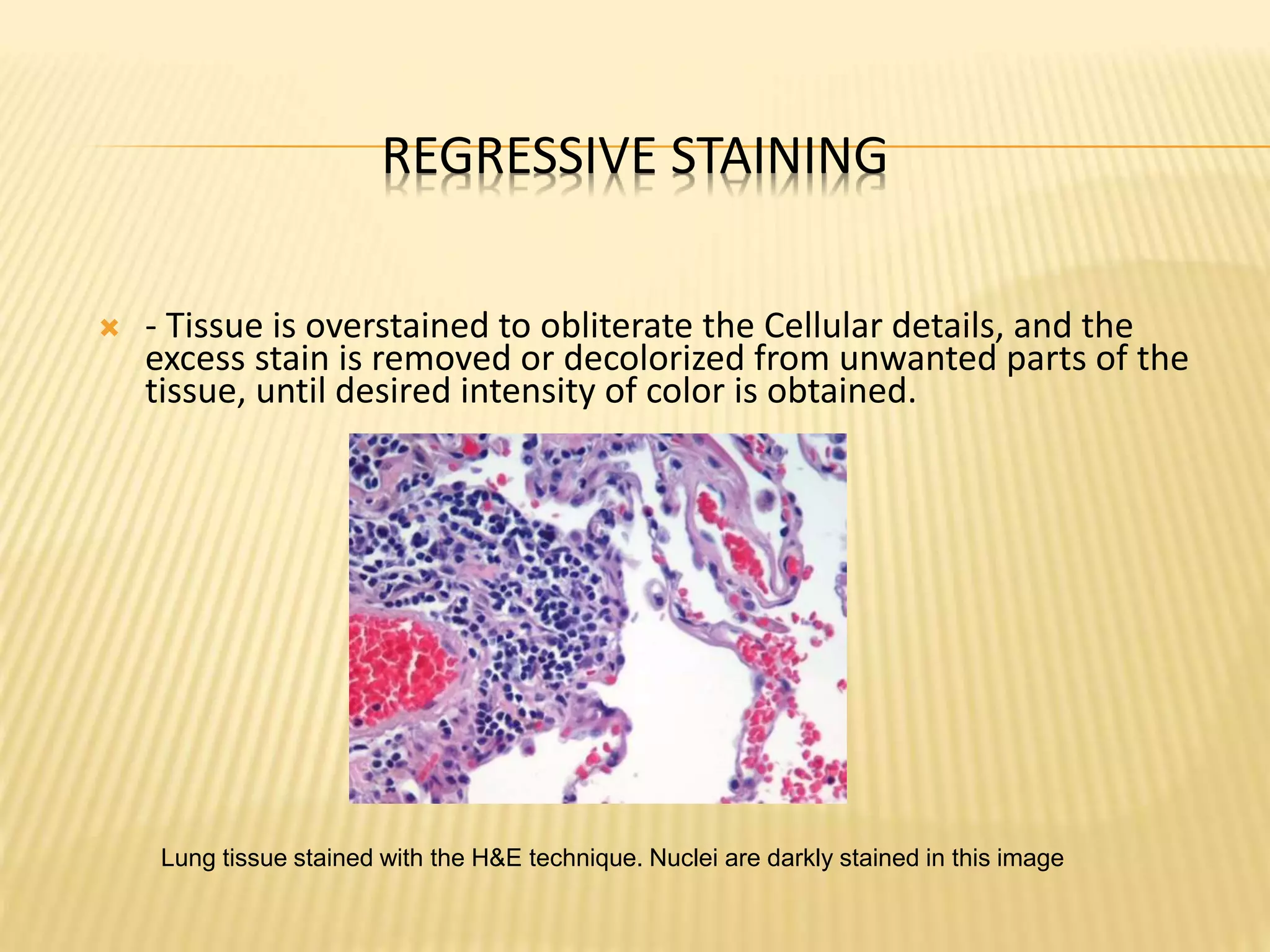 REGRESSIVE STAINING
 - Tissue is overstained to obliterate the Cellular details, and the
excess stain is removed or decolorized from unwanted parts of the
tissue, until desired intensity of color is obtained.
Lung tissue stained with the H&E technique. Nuclei are darkly stained in this image
 