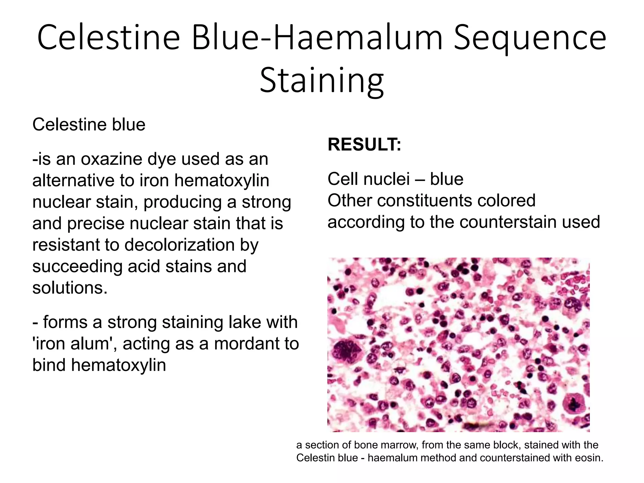 Celestine Blue-Haemalum Sequence
Staining
Celestine blue
-is an oxazine dye used as an
alternative to iron hematoxylin
nuclear stain, producing a strong
and precise nuclear stain that is
resistant to decolorization by
succeeding acid stains and
solutions.
- forms a strong staining lake with
'iron alum', acting as a mordant to
bind hematoxylin
RESULT:
Cell nuclei – blue
Other constituents colored
according to the counterstain used
a section of bone marrow, from the same block, stained with the
Celestin blue - haemalum method and counterstained with eosin.
 
