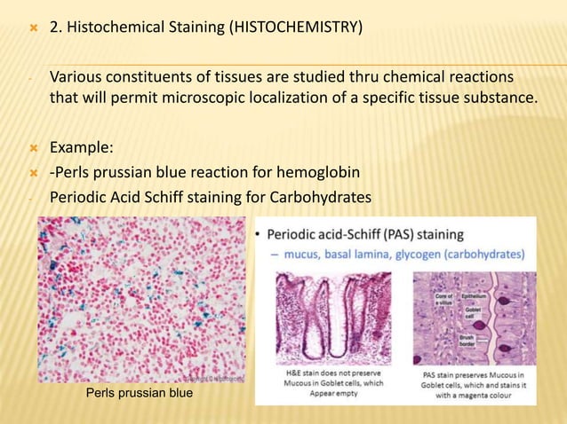 Structural Stain Examples What Are The Structural Components Of A Stain? – AOJP