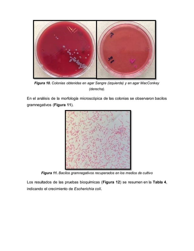 Urocultivo y antibiograma