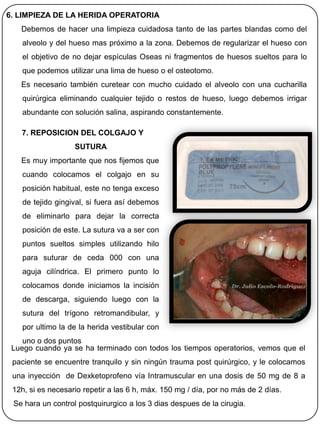 6. LIMPIEZA DE LA HERIDA OPERATORIA
   Debemos de hacer una limpieza cuidadosa tanto de las partes blandas como del
   alveolo y del hueso mas próximo a la zona. Debemos de regularizar el hueso con
   el objetivo de no dejar espículas Oseas ni fragmentos de huesos sueltos para lo
   que podemos utilizar una lima de hueso o el osteotomo.
   Es necesario también curetear con mucho cuidado el alveolo con una cucharilla
   quirúrgica eliminando cualquier tejido o restos de hueso, luego debemos irrigar
   abundante con solución salina, aspirando constantemente.

   7. REPOSICION DEL COLGAJO Y
                   SUTURA
   Es muy importante que nos fijemos que
   cuando colocamos el colgajo en su
   posición habitual, este no tenga exceso
   de tejido gingival, si fuera así debemos
   de eliminarlo para dejar la correcta
   posición de este. La sutura va a ser con
   puntos sueltos simples utilizando hilo
   para suturar de ceda 000 con una
   aguja cilíndrica. El primero punto lo
   colocamos donde iniciamos la incisión
   de descarga, siguiendo luego con la
   sutura del trígono retromandibular, y
   por ultimo la de la herida vestibular con
    uno o dos puntos
 Luego cuando ya se ha terminado con todos los tiempos operatorios, vemos que el
 paciente se encuentre tranquilo y sin ningún trauma post quirúrgico, y le colocamos
 una inyección de Dexketoprofeno vía Intramuscular en una dosis de 50 mg de 8 a
 12h, si es necesario repetir a las 6 h, máx. 150 mg / día, por no más de 2 días.
 Se hara un control postquirurgico a los 3 dias despues de la cirugia.
 