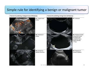 Simple rule for identifying a benign or malignant tumor

Dr. To Mai Xuan Hong

18

 